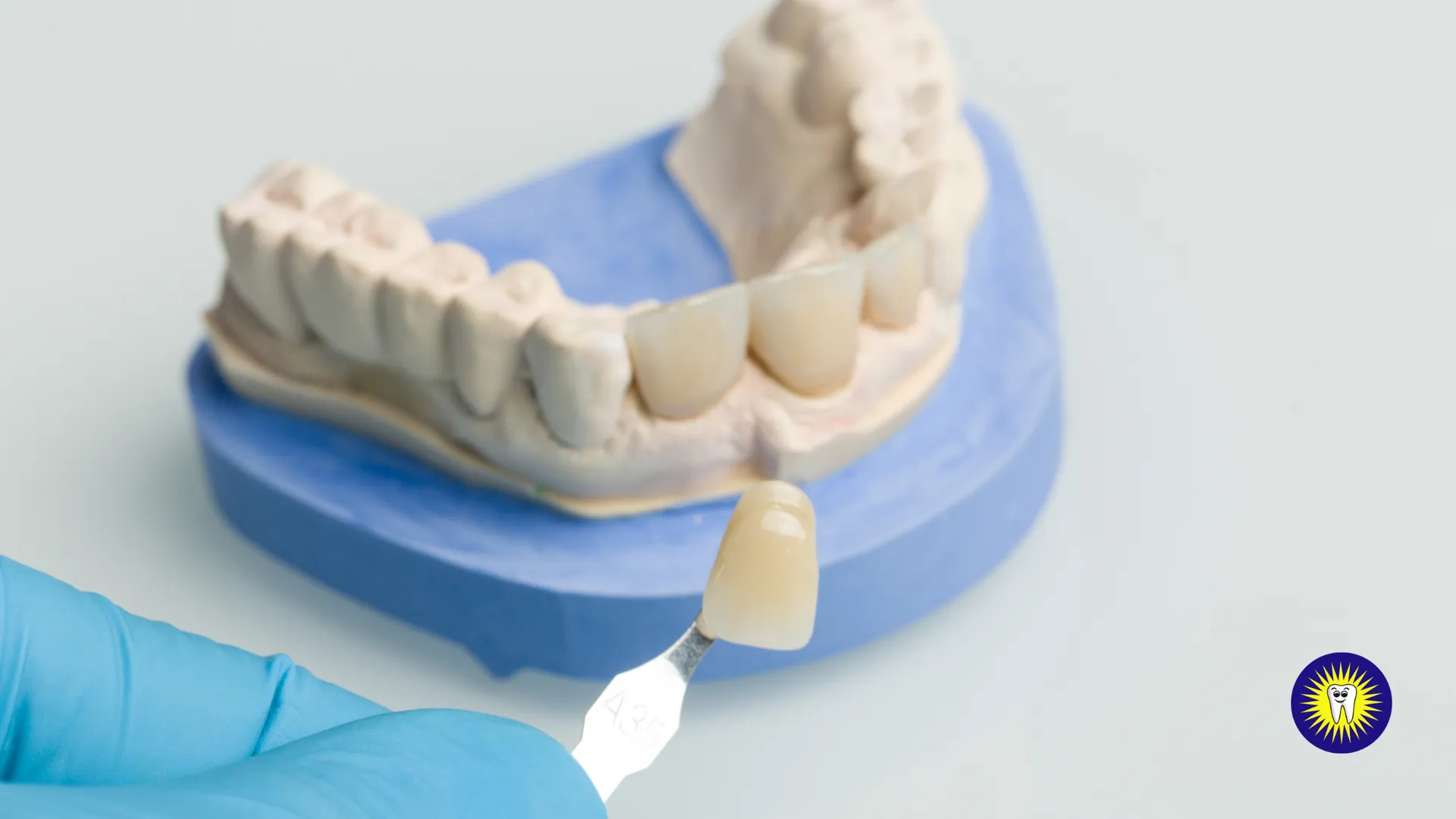 Dental crown procedures in Toronto