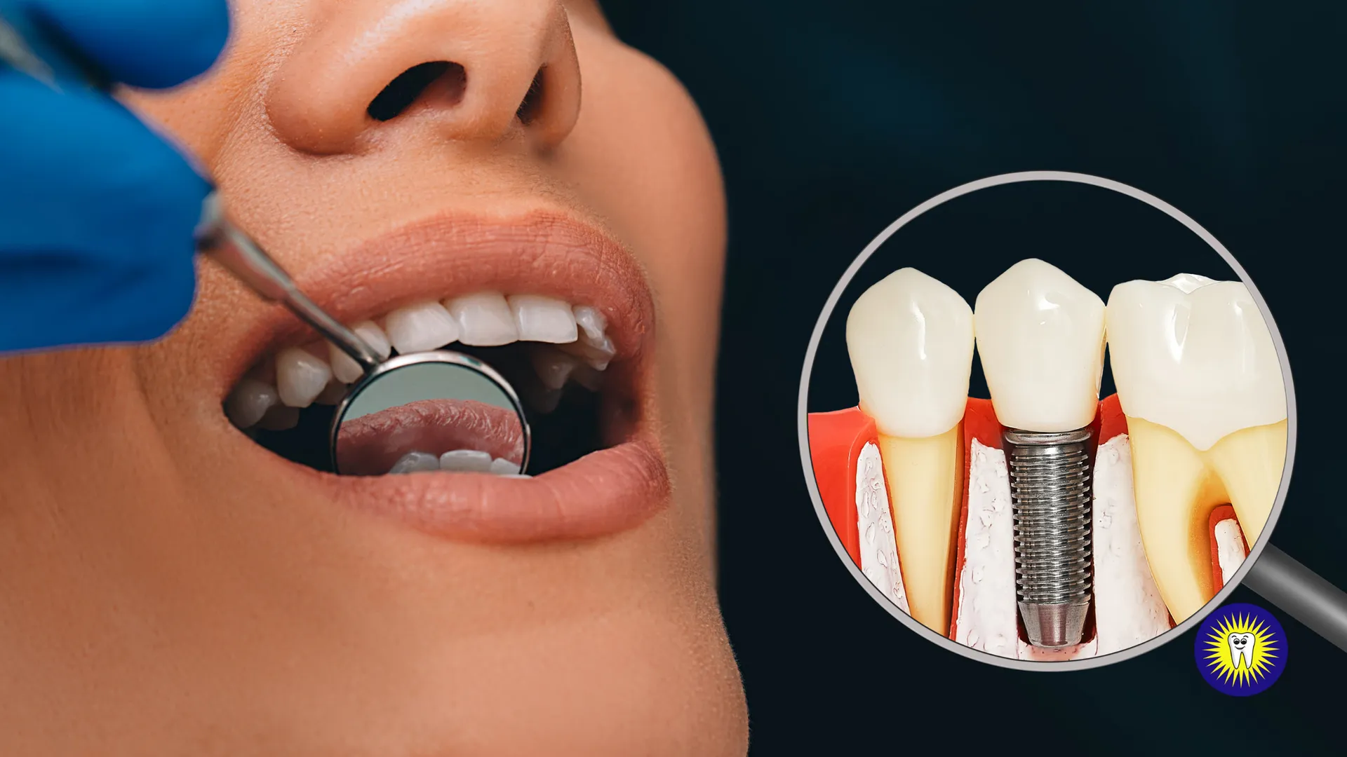 Dental implant risks