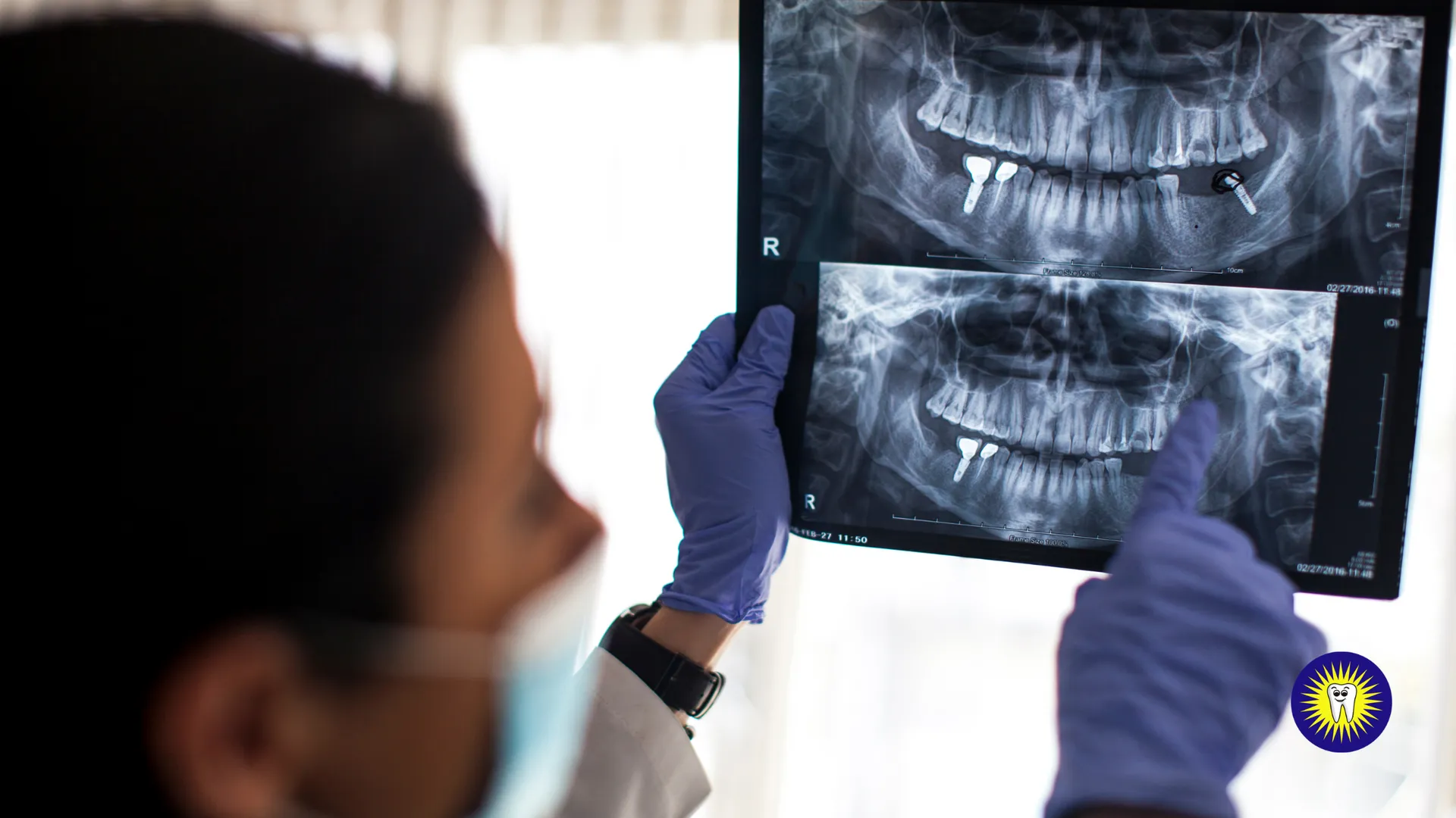 Why Our Dentists Might Recommend Dental Implants for Your Treatment Plan
